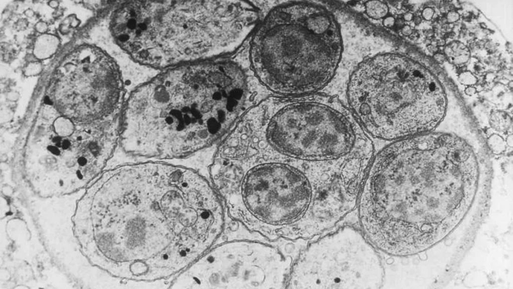 10 surprising facts about the ‘mind-control’ parasite Toxoplasma gondii