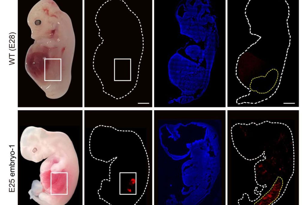 Human kidneys have been partially grown in pigs for the