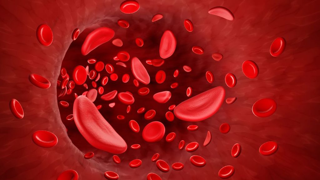 1st gene therapies for sickle cell cleared by FDA, including