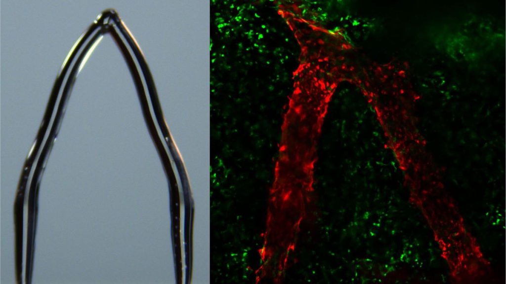 ‘Ice printing’ tiny sculptures could help scientists engineer blood vessels