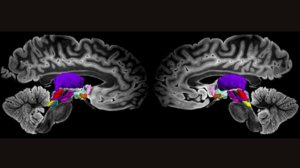 Super-detailed map of brain cells that keep us awake could